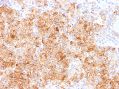 FFPE human parathyroid sections stained with 100 ul anti-Chromogranin A (clone CHGA/1731R) at 1:200. HIER epitope retrieval prior to staining was performed in 10mM Citrate, pH 6.0.